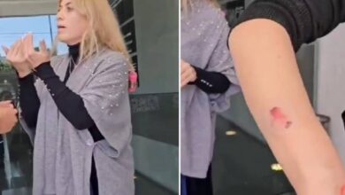 Mujer ataca con mordiscos a manicuristas para no pagarle 