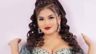 ¿Quién era Muñequita Milly, cantante que murió por liposucción?